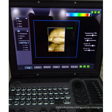 Portable Color Doppler Ultrasound with CE